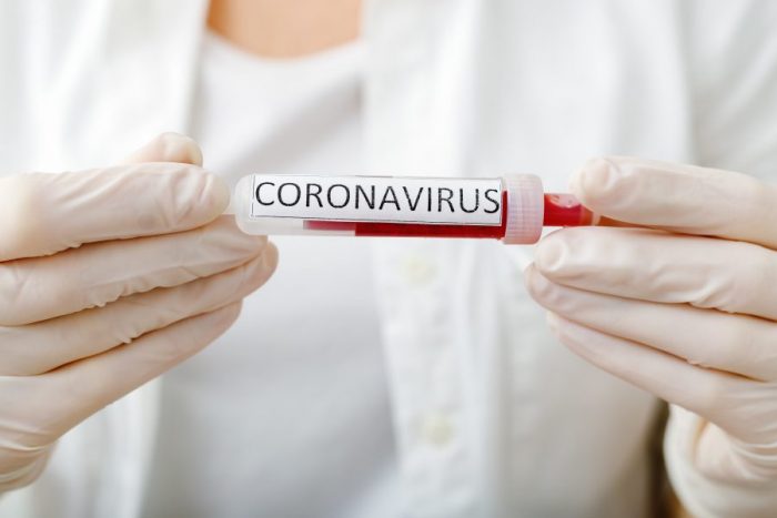 coronavirus covid-19 test