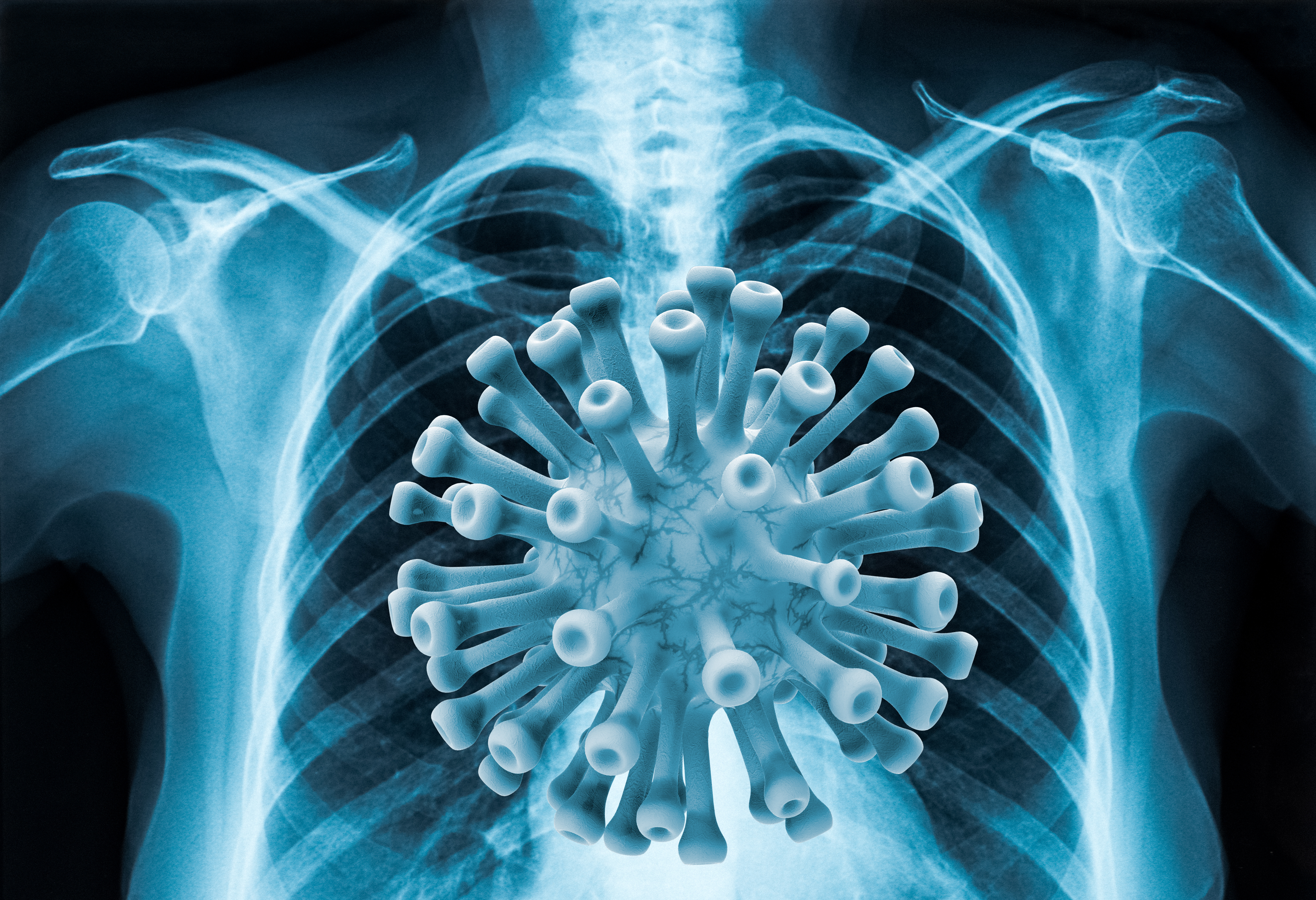 coronavirus covid-19 poumons
