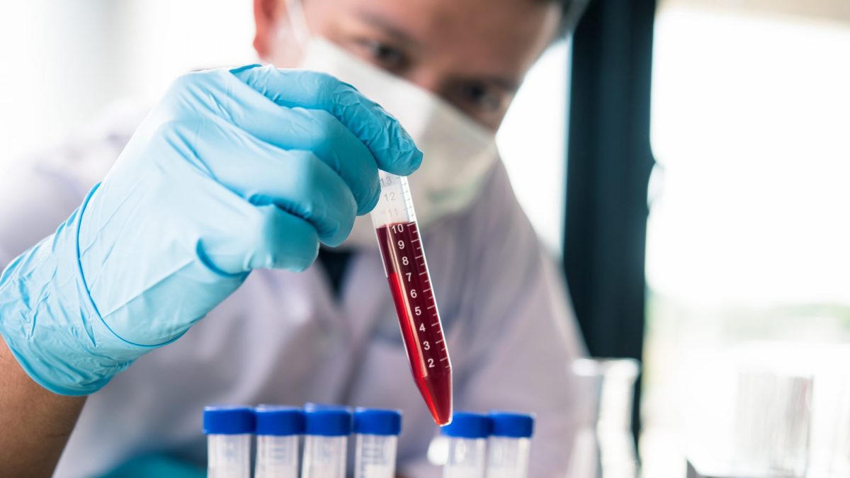 Le VIH, une autre épidémie en parallèle