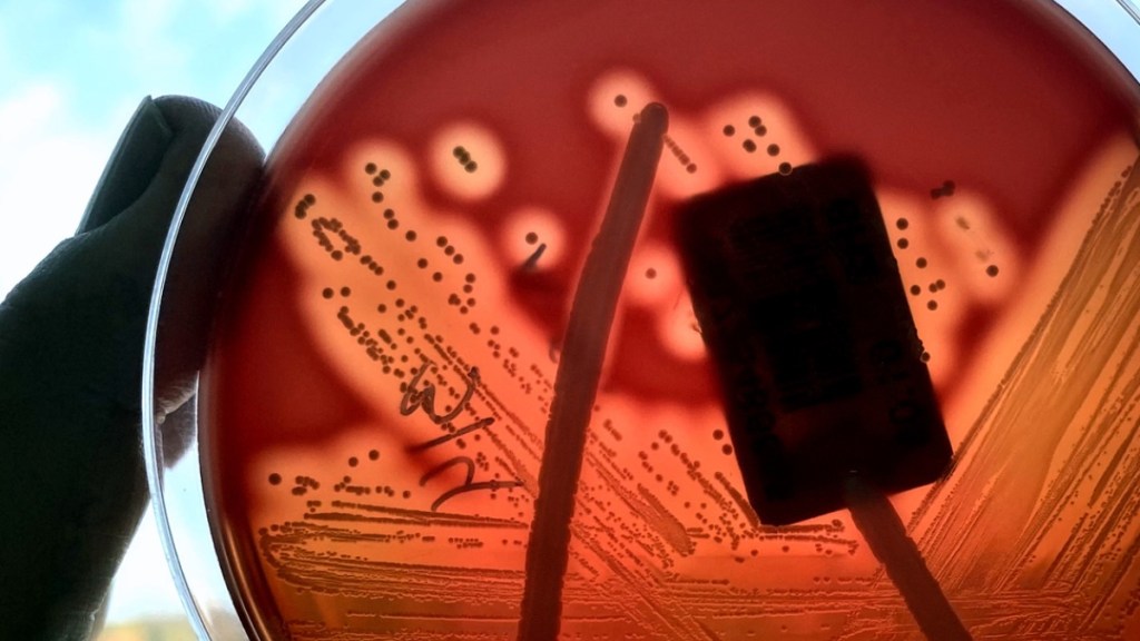 Le taux d'infection au streptocoque A est en hausse au Québec.