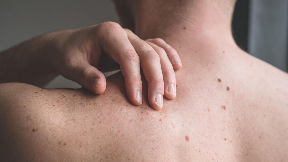Comment repérer un début de cancer de la peau?